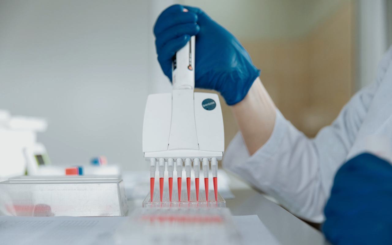 Close-up of a lab technician using a multichannel pipette for testing in a laboratory.